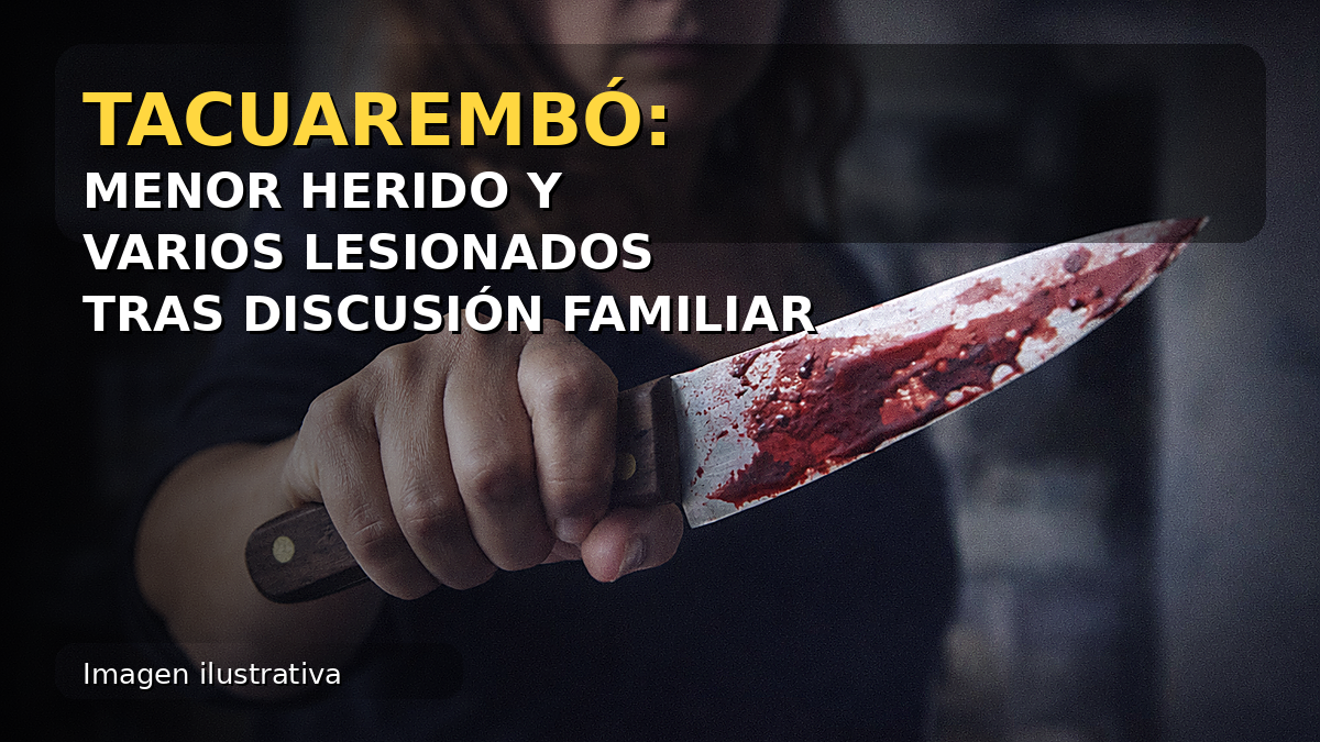 Imagen ilustrativa: Tacuarembó, menor herido y varios lesionados tras discusión familiar